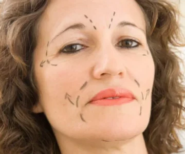 Arcplasztika Dr. Fábián Zsolt plasztikai sebész klinikáján