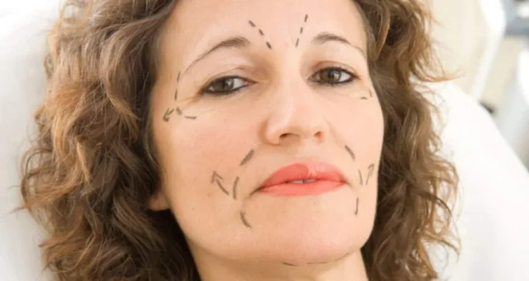 Arcplasztika Dr. Fábián Zsolt plasztikai sebész klinikáján