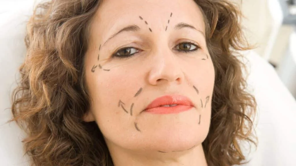 Arcplasztika Dr. Fábián Zsolt plasztikai sebész klinikáján