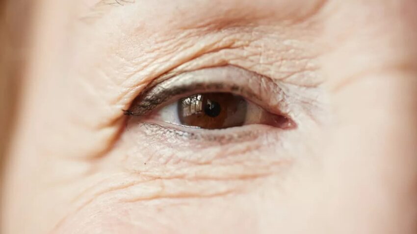 szemhéjfiatalítás Budapest magánrendelőiben